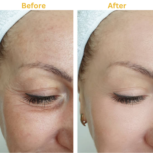 Elara Firming Cream